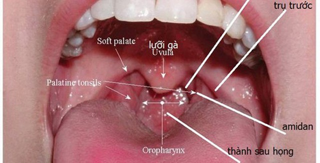 Không muốn chết vì ung thư vòm họng, đừng bỏ qua dấu hiệu sau Không muốn chết vì ung thư vòm họng, đừng bỏ qua dấu hiệu sau
