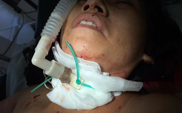 Kẻ cắt cổ nữ chủ quán cắt tóc bị bắt Kẻ cắt cổ nữ chủ quán cắt tóc bị bắt