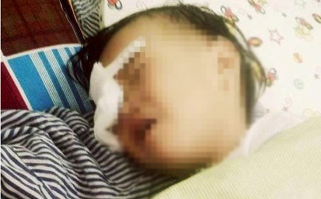 Nghệ An: Xót xa bé gái 2 tuổi bị gà chọi mổ mù một mắt Nghệ An: Xót xa bé gái 2 tuổi bị gà chọi mổ mù một mắt