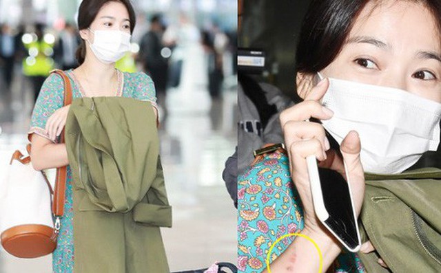 Báo Hàn đặt nghi vấn Song Hye Kyo không đeo nhẫn, nhưng vết bầm cùng hành động lấy áo che đi của cô mới gây chú ý Báo Hàn đặt nghi vấn Song Hye Kyo không đeo nhẫn, nhưng vết bầm cùng hành động lấy áo che đi của cô mới gây chú ý