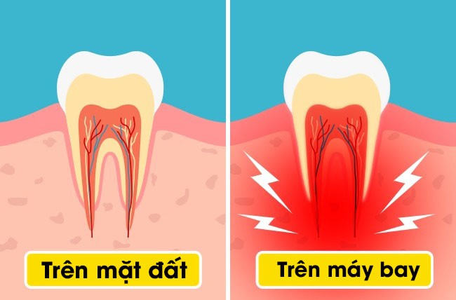 10 điều có thể xảy ra với cơ thể khi đi máy bay: Các bạn gái sợ nhất điều thứ 4 - Ảnh 9.