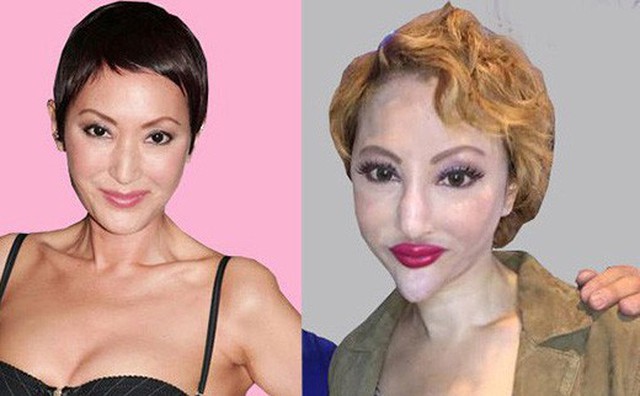 Những ca phẫu thuật thẩm mỹ thất bại của showbiz: Đẹp phút chốc, nuối tiếc cả đời! Những ca phẫu thuật thẩm mỹ thất bại của showbiz: Đẹp phút chốc, nuối tiếc cả đời!