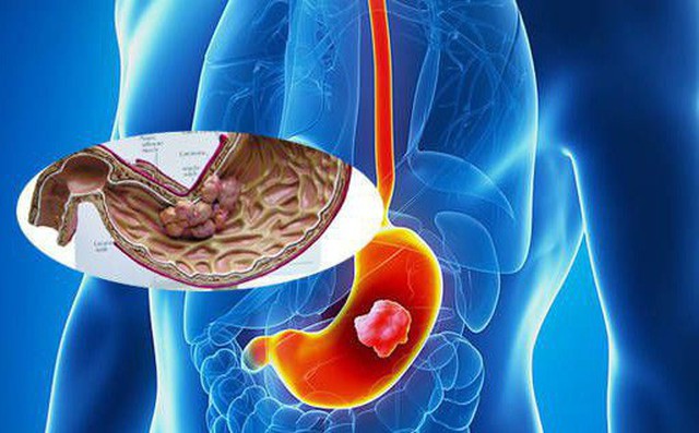 Nguyên PGĐ Bệnh viện K vạch mặt