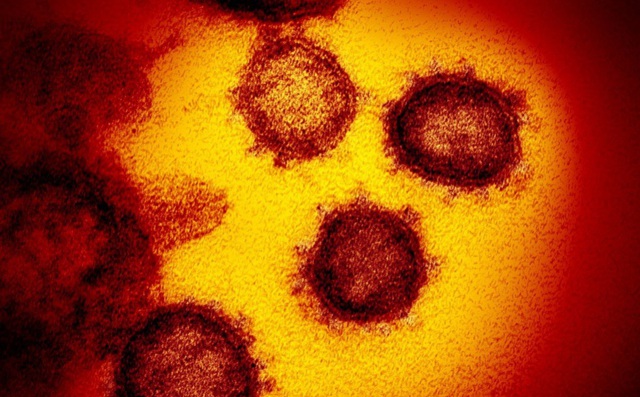 Nghiên cứu của Mỹ: Virus COVID-19 có xu hướng bám vào tế bào người nhiều hơn virus SARS từ 10 tới 20 lần