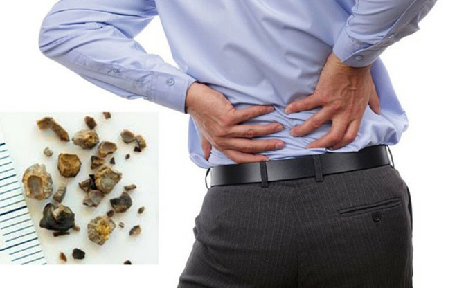 Điều xảy ra nếu bạn uống nước ấm mỗi sáng khi thức dậy? - Ảnh 5. Điều xảy ra nếu bạn uống nước ấm mỗi sáng khi thức dậy? - Ảnh 5.